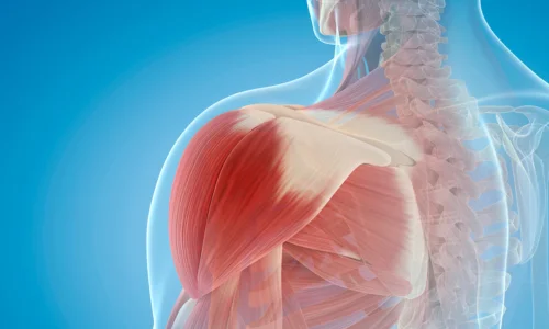 Shoulder Replacement Surgery